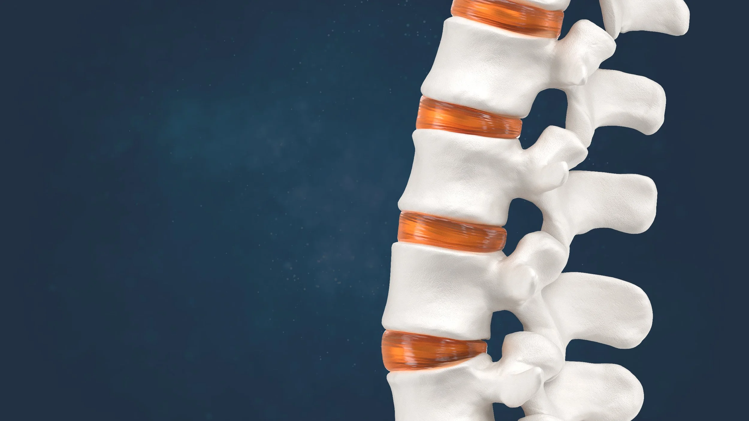 Lumbar Spine Patient Education — Camber Spine Med Tech